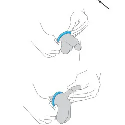 Erectionrings - Anneaux pour maintien de l'érection